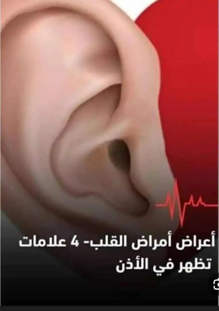     ارشيفية  