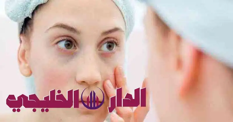     تورم الوجه: الأسباب المتنوعة والعلاجات الطبيعية الفعالة 