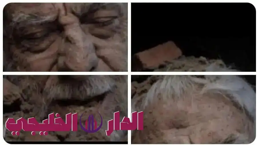     زراعها الجواسيس 