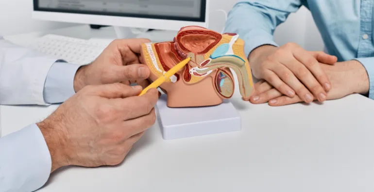     سرطان القولون  