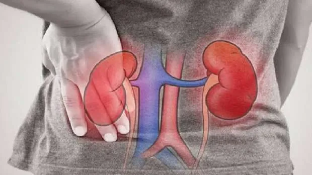   مشروبات طبيعية تساعد على تنظيف الكلى: 5 أنواع تدعم صحتها بانتظام