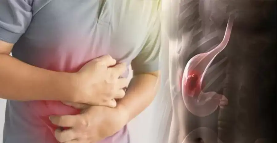     إشارة تحذيرية في الوجه قد تكشف عن مرض خطير.. علامات سرطانالمعدة 