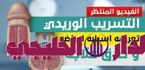     تسريب العضو 