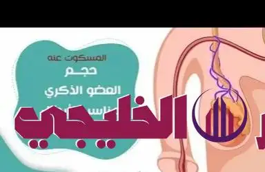     ضعف الانتصاب 