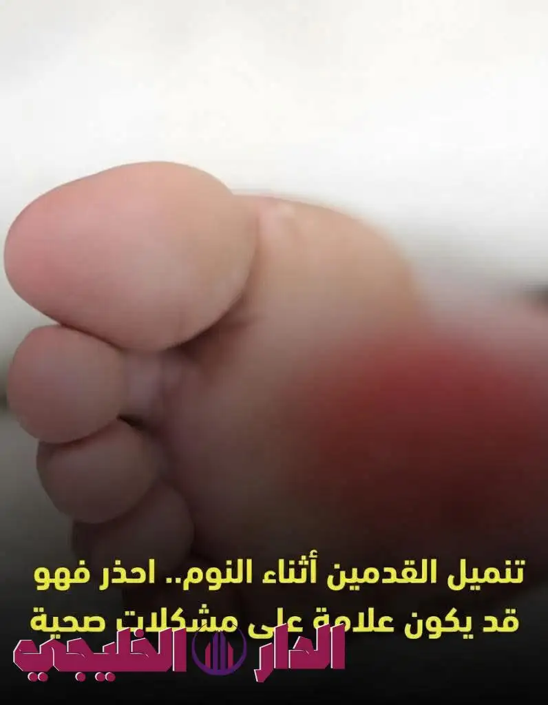     التنميل 