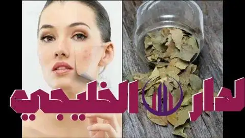    ورق الغار 